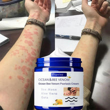 Bee Venom &Ocean Psoriasis Healing Cream ( Pack Of 1 ) image 5